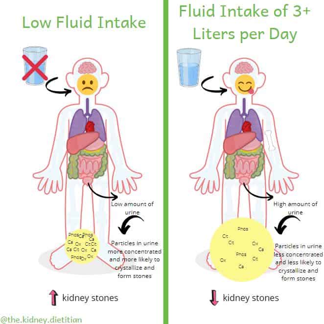 Cartoon showing that drinking water reduces the concentration of calcium and oxalate in the urine, thereby reducing the risk of kidney stones.