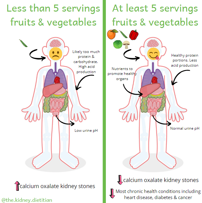 Cartoon showing that consuming at least 5 servings of fruits and vegetables will reduce risk of calcium oxalate kidney stones by increasing urine pH.  Fruits and vegetables will also reduce the risk of most chronic health conditions such as heart disease, diabetes & cancer.