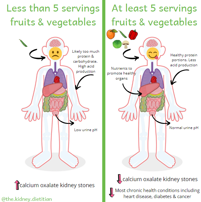 Cartoon showing that consuming at least 5 servings of fruits and vegetables will reduce risk of calcium oxalate kidney stones by increasing urine pH. Fruits and vegetables will also reduce the risk of most chronic health conditions such as heart disease, diabetes & cancer.